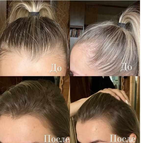 Изображение [jenechka_el_cantante] Марафон по восстановлению волос.17 сезон (2020) в посте 252226